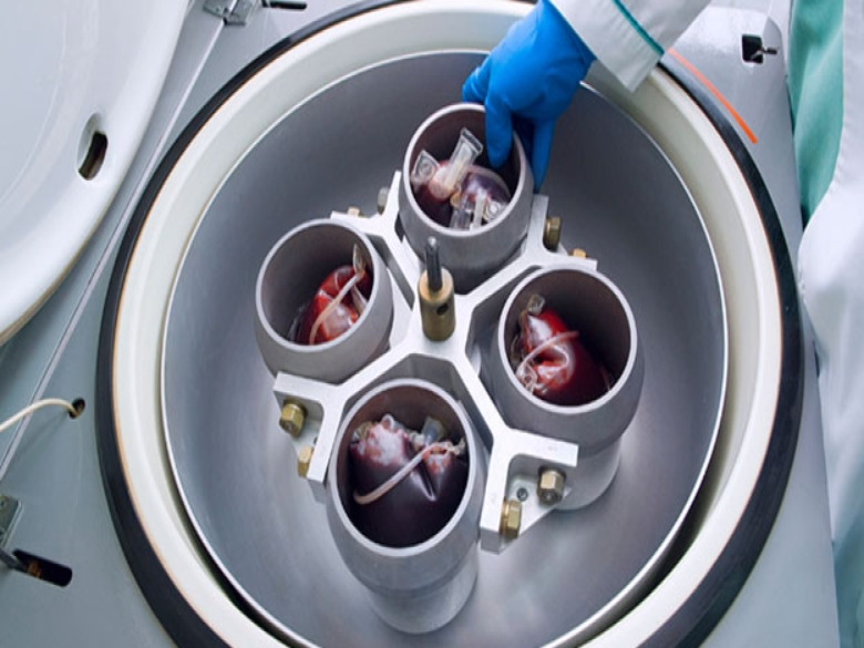 Top 10 blood sample centrifuge manufacturers in Toronto, Canada