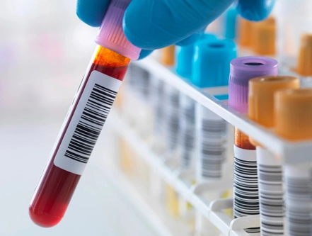Recommendations For The Use Of Laboratory Centrifuges In Major Fields
